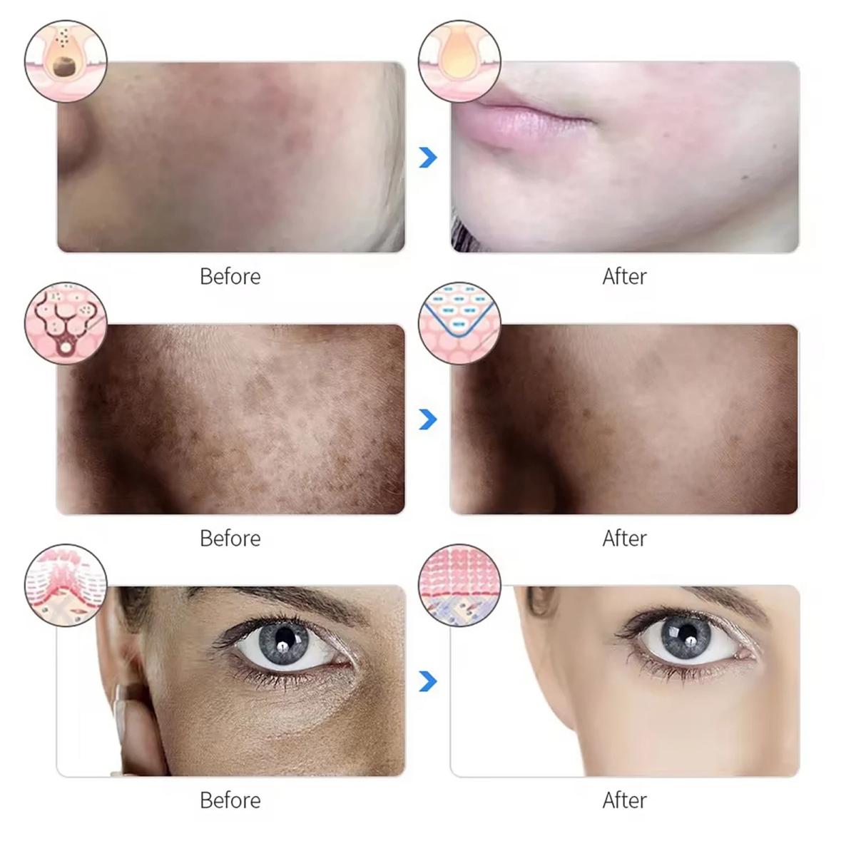 Cellara™ LED Light Therapy Face Mask | 7-Wavelength Skin Treatment | CE Certified